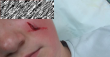Дете е с шевове на лицето след агресия в час по физическо възпитание